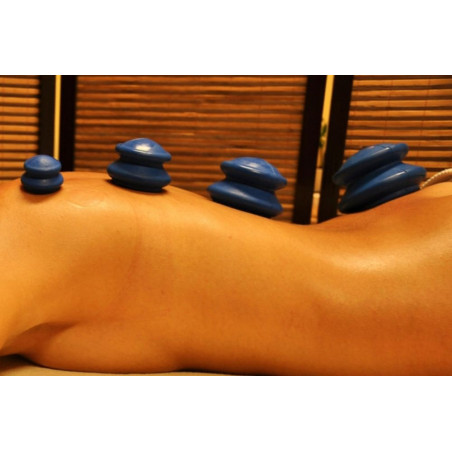 Kiniškos vakuuminės masažo taurelės 4 vnt, guminės