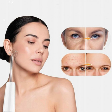 Veido valymo aparatas Darsonval 30W Veido valymo aparatas Darsonval 30W